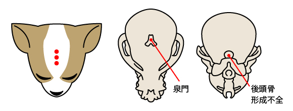 大泉門開存(ペコ)