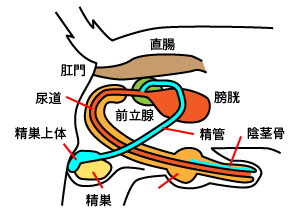 陰睾丸 (停留睾丸)